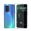 Kép 8/8 - Ultra Clear 0.5mm Case Gel TPU Cover for OnePlus 9 átlátszó