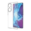 Kép 4/8 - Ultra Clear 0,5 mm-es Honor 60 Pro zselés borítás átlátszó